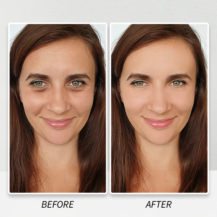 LIMETOW™ Instant Eye Cream Tightener image LIMETOW™ Instant Eye Cream Tightener