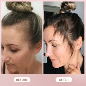 LIMETOW® H-Regrow 2.0 image LIMETOW® H-Regrow 2.0