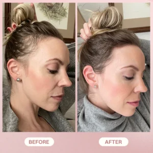 LIMETOW® H-Regrow 2.0 image LIMETOW® H-Regrow 2.0