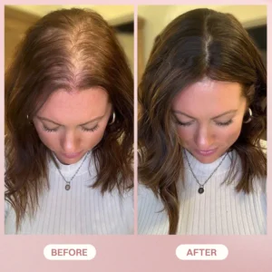 LIMETOW® H-Regrow 2.0 image LIMETOW® H-Regrow 2.0