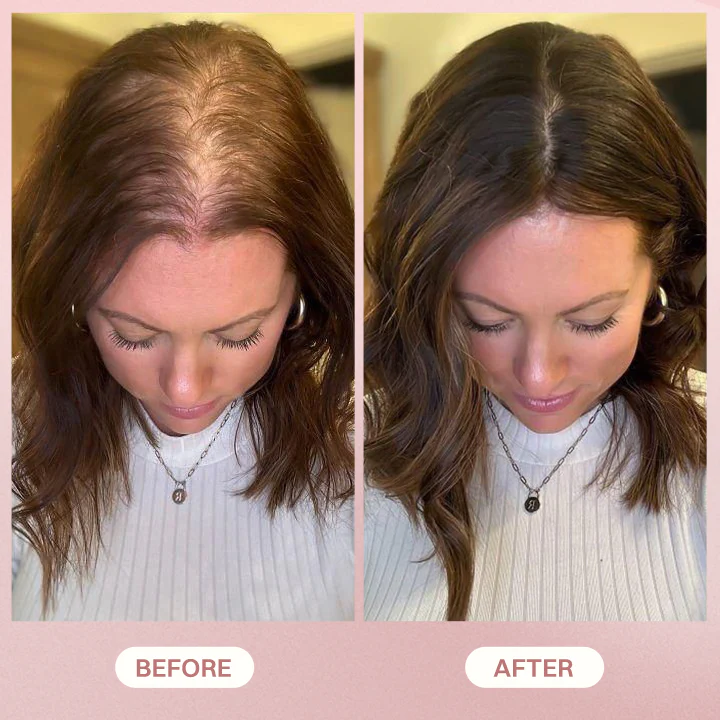 LIMETOW® H-Regrow 2.0 image LIMETOW® H-Regrow 2.0