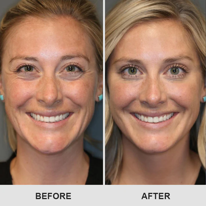 LIMETOW™ Retinol Eye Stick image LIMETOW™ Retinol Eye Stick - Image 9