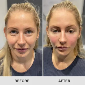 LIMETOW™ Retinol Eye Stick image LIMETOW™ Retinol Eye Stick