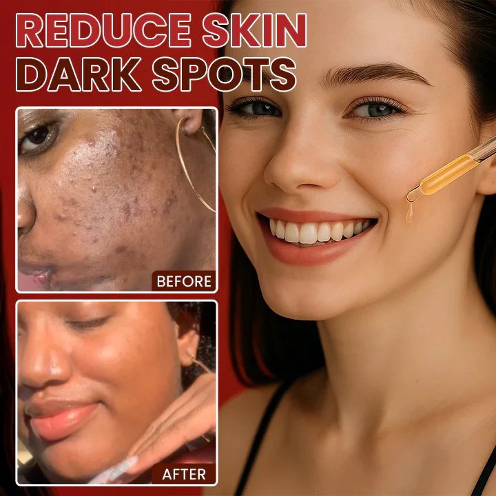 LIMETOW® Dark Spots Essence image LIMETOW® Dark Spots Essence
