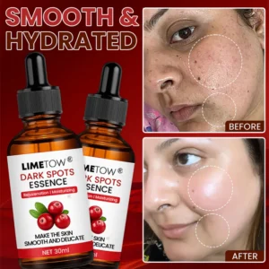 LIMETOW® Dark Spots Essence image LIMETOW® Dark Spots Essence
