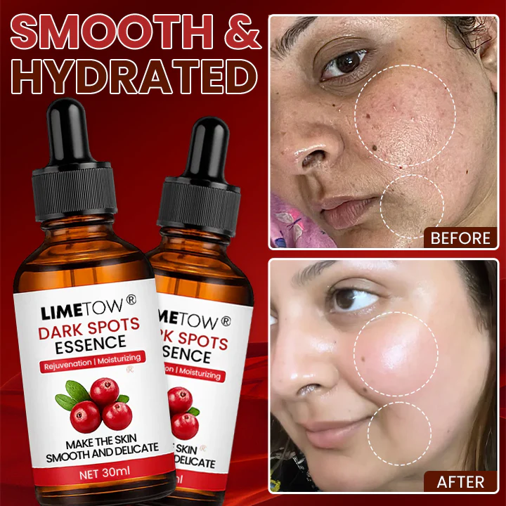 LIMETOW® Dark Spots Essence image LIMETOW® Dark Spots Essence