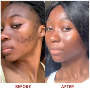 LIMETOW® Dark Spots Essence image LIMETOW® Dark Spots Essence