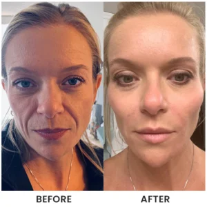 LIMETOW® Instant Face Tightener Cream image LIMETOW® Instant Face Tightener Cream