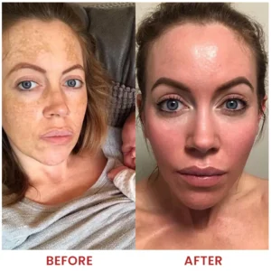 LIMETOW® Dark Spots Essence image LIMETOW® Dark Spots Essence