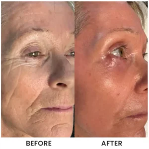 LIMETOW® Instant Face Tightener Cream image LIMETOW® Instant Face Tightener Cream