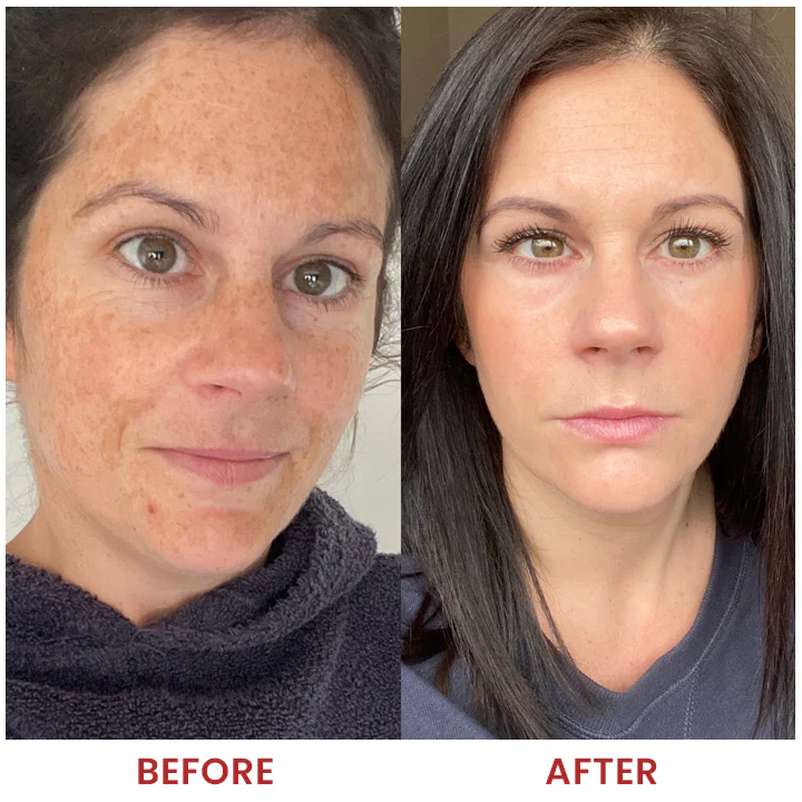 LIMETOW® Dark Spots Essence image LIMETOW® Dark Spots Essence - Image 16