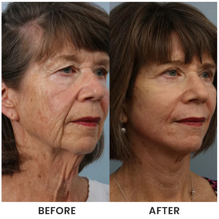 LIMETOW® Instant Face Tightener Cream image LIMETOW® Instant Face Tightener Cream - Image 13