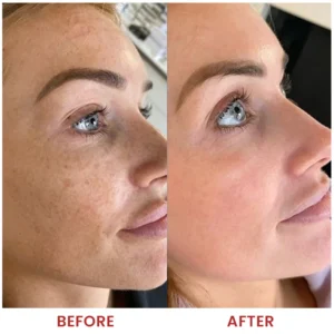 LIMETOW® Dark Spots Essence image LIMETOW® Dark Spots Essence