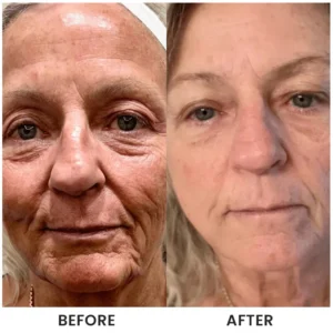 LIMETOW® Instant Face Tightener Cream image LIMETOW® Instant Face Tightener Cream