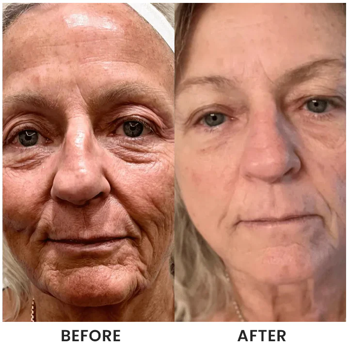 LIMETOW® Instant Face Tightener Cream image LIMETOW® Instant Face Tightener Cream - Image 12