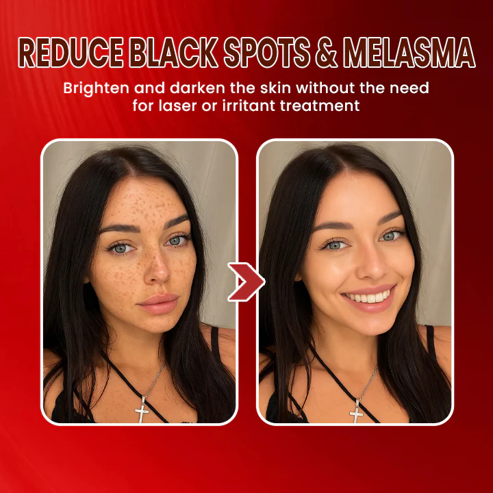 LIMETOW® Dark Spots Essence image LIMETOW® Dark Spots Essence