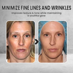 LIMETOW® Instant Face Tightener Cream image LIMETOW® Instant Face Tightener Cream