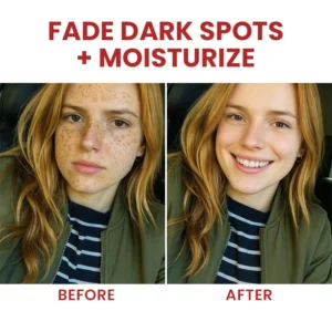 LIMETOW® Dark Spots Essence image LIMETOW® Dark Spots Essence