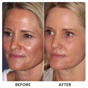 LIMETOW® Instant Face Tightener Cream image LIMETOW® Instant Face Tightener Cream