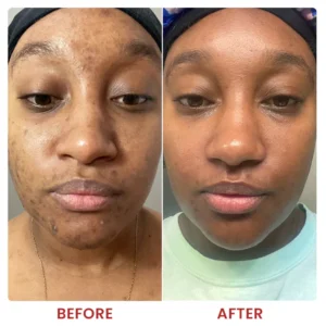 LIMETOW® Dark Spots Essence image LIMETOW® Dark Spots Essence