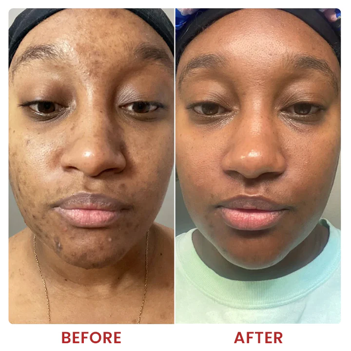 LIMETOW® Dark Spots Essence image LIMETOW® Dark Spots Essence