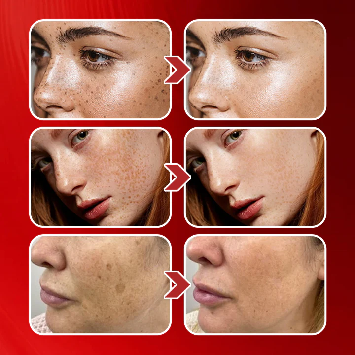 LIMETOW® Dark Spots Essence image LIMETOW® Dark Spots Essence