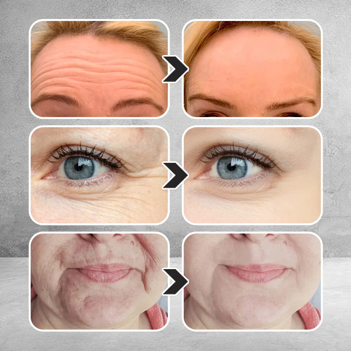 LIMETOW® Instant Face Tightener Cream image LIMETOW® Instant Face Tightener Cream - Image 10