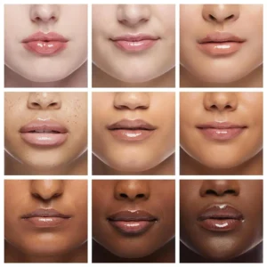 LIMETOW® Lip Plumper Kit image LIMETOW® Lip Plumper Kit