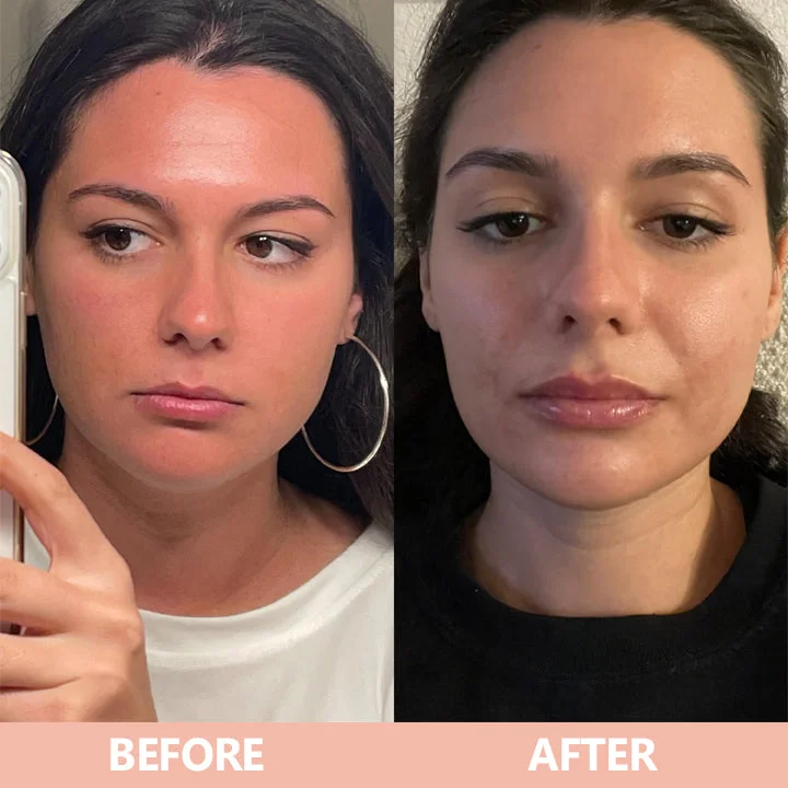 LIMETOW® Lip Plumper Kit image LIMETOW® Lip Plumper Kit - Image 11